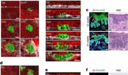 癌症研究人员发现抑制癌基因表达细胞的机制