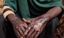 联合国报告称，苏丹一座城市的种族暴力造成多达1.5万人死亡