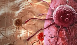 研究发现，肺癌诊断可能使患者自杀的风险最高