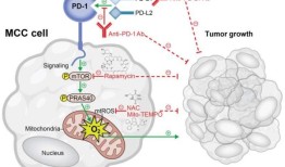 研究发现新的PD-1免疫检查点机制促进默克尔细胞癌生长