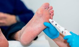 苏格兰学生发明了一种装置，使人们免于截肢